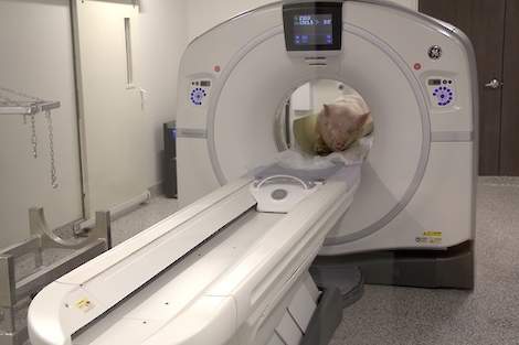 CT-scanning in Delta Canada